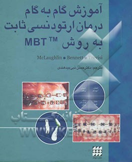 آموزش گام به گام درمان ارتودنسی ثابت به روش MBT