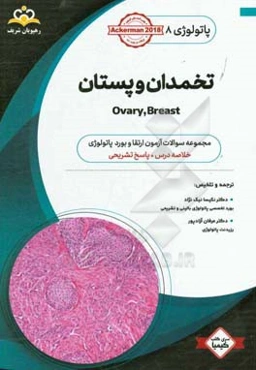 پاتولوژی: تخمدان و پستان: خلاصه درس به همراه مجموعه سوالات آزمون ارتقاء و بورد پاتولوژی با پاسخ تشریحی