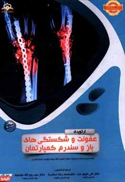 ارتوپدی: عفونت و شکستگی‌های باز و سندرم کمپارتمان: خلاصه درس به همراه مجموعه سوالات آزمون ارتقاء و بورد ارتوپدی با پاسخ تشریحی