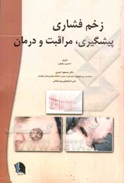 زخم فشاری: پیشگیری، مراقبت و درمان