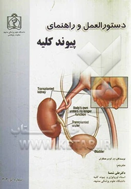 دستورالعمل و راهنمای پیوند کلیه