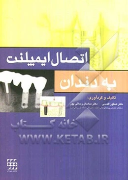 اتصال ایمپلنت به دندان: مفاهیم بنیادی و پروسه کلینیکی
