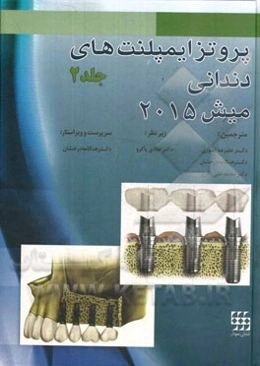 پروتز ایمپلنت‌های دندانی میش 2015