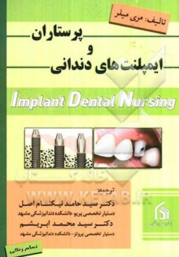 پرستاران و ایمپلنت‌های دندانی