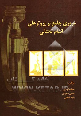 مروری جامع بر پروتزهای اندام فوقانی