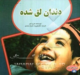 دندان لق شده