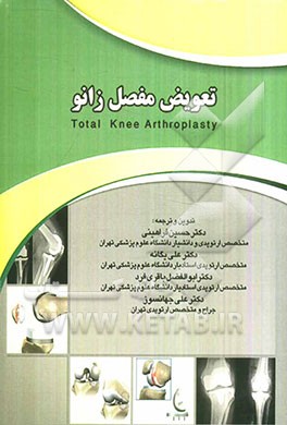 تعویض مفصل زانو