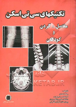 تکنیکهای سی‌تی‌اسکن مفاصل و کودکان
