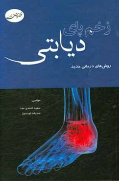 زخم پای دیابتی: روش‌های درمانی جدید