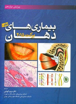 بیماریهای دهان برکت 2015