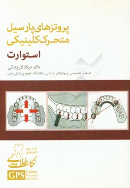 پروتزهای پارسیل متحرک کلینیکی استورات