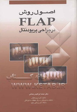 اصول روش Flap در جراحی پریودنتال