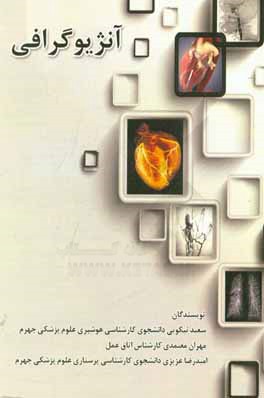 آنژیوگرافی