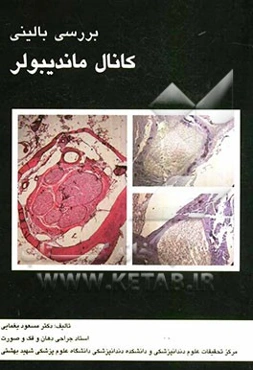 بررسی بالینی کانال ماندیبولر