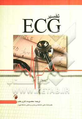 تفسیر ECG