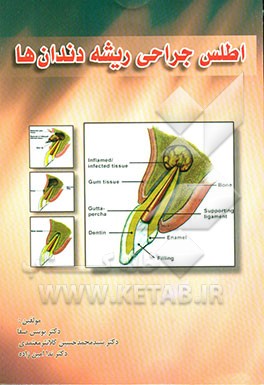 اطلس جراحی ریشه دندان‌ها