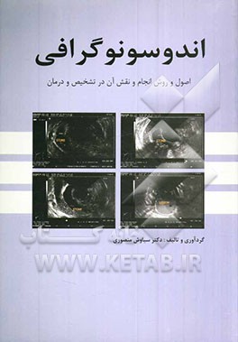 اندوسونوگرافی: اصول و روش انجام و نقش آن در تشخیص و درمان