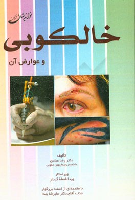 خالکوبی و عوارض آن