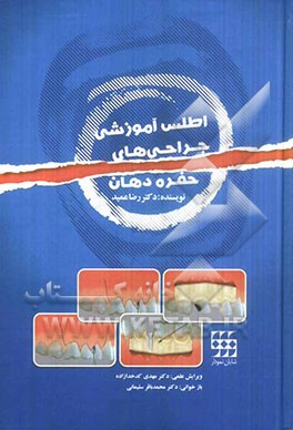 اطلس آموزشی جراحی‌های حفره دهان