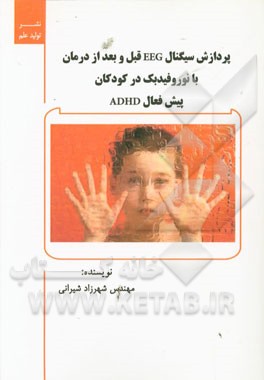 پردازش سیگنال EEG قبل و بعد از درمان با نوروفیدبک در کودکان پیش‌فعال ADHD (پایان‌نامه‌ی کارشناسی مهندسی پزشکی - بیوالکتریک)