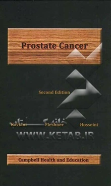 Prostate cancer