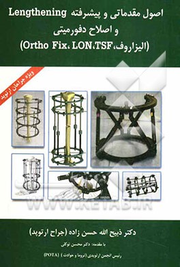 اصول مقدماتی و پیشرفته Lengthening و اصلاح دفورمیتی (الیزاروف، Ortho Fix, Lon, TSF)