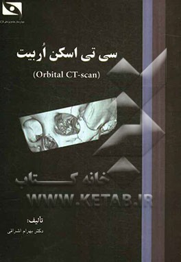 سی تی اسکن (Orbital CT-Scan)