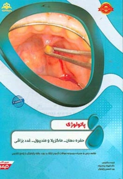 پاتولوژی: حفره دهان - ماگزیلا و مندیبول - غدد بزاقی: خلاصه درس به همراه مجموعه سوالات آزمون ارتقاء و بورد پاتولوژی با پاسخ تشریحی