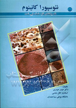 نئوسپوراکانینوم تک‌یاخته‌ای تازه شناسایی شده