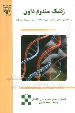 ژنتیک سندرم داون