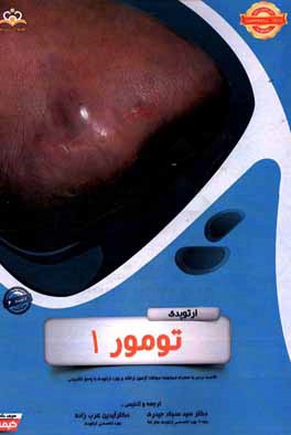 ارتوپدی: تومور 1: خلاصه درس به همراه مجموعه سوالات آزمون ارتقاء و بورد ارتوپدی با پاسخ تشریحی Campbell 2013