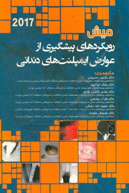 رویکردهای پیشگیری از عوارض ایمپلنت‌های دندانی (میش)