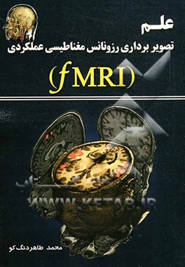 علم تصویربرداری رزونانس مغناطیسی عملکردی (FMRI)