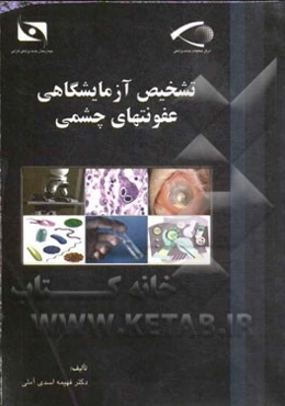 تشخیص آزمایشگاهی عفونت‌های چشمی