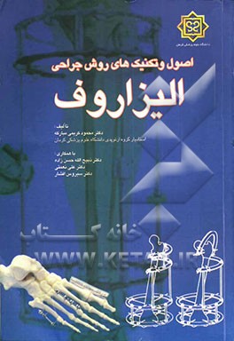 اصول و تکنیک‌های روش جراحی الیزاروف