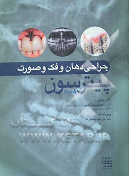 جراحی دهان، فک و صورت پیترسون 2008 (به انضمام اصول فارماکولوژیک و مراقبت‌های لازم قبل از عمل از درسنامه جراحی فک و صورت)