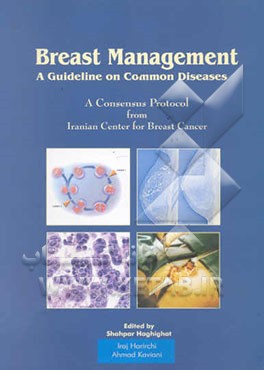 Breast management: a guideline on common diseases
