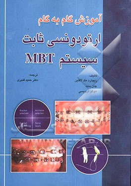 آموزش گام به گام ارتودونسی ثابت سیستم MBT