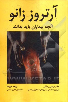 آرتروز زانو: آنچه بیماران باید بدانند