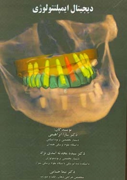 دیجیتال ایمپلنتولوژی