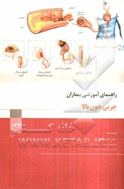 چربی خون بالا