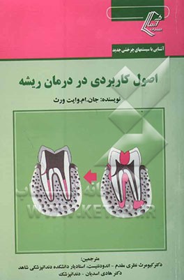 اصول کاربردی در درمان ریشه دندان: آشنایی با سیستم‌های چرخشی جدید