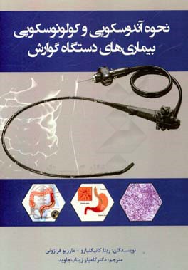 نحوه آندوسکوپی و کولونوسکوپی بیماری‌های دستگاه گوارش