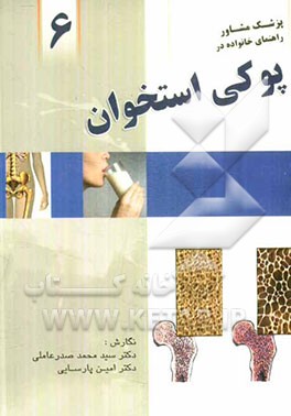 راهنمای خانواده در پوکی استخوان