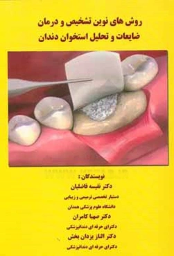 روش‌های نوین تشخیص و درمان ضایعات و تحلیل استخوان دندان