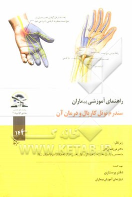 سندرم تونل کارپال و درمان آن