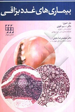 بیماری‌های غدد بزاقی