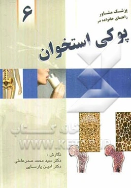 راهنمای خانواده در پوکی استخوان