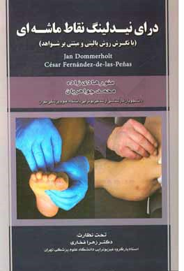 درای نیدلینگ نقاط ماشه‌ای: روش بالینی و مبتنی بر شواهد