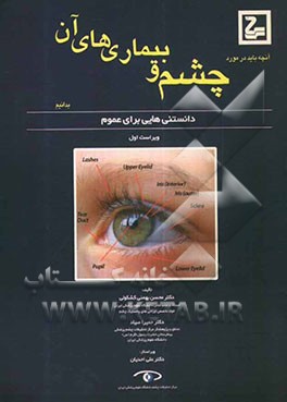 آنچه باید درباره چشم و بیماریهای آن بدانیم